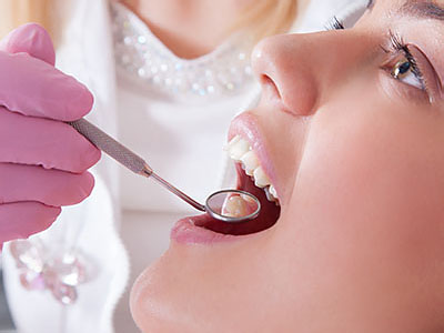 Dental Fillings in Yonkers